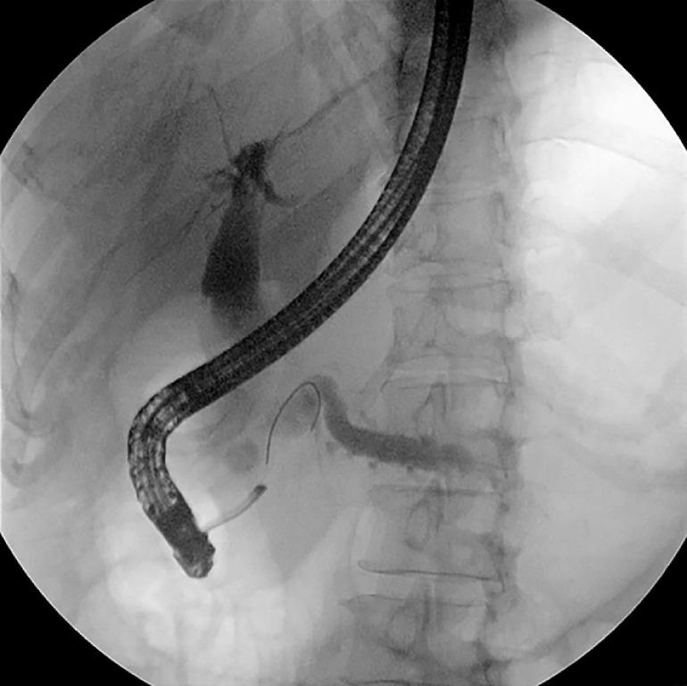 https://cdn.ncbi.nlm.nih.gov/pmc/blobs/ac11/11309848/48ee752659dd/10-1055-a-2361-1299_23612338.jpg