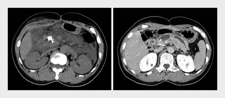 https://cdn.ncbi.nlm.nih.gov/pmc/blobs/ac11/11309848/53ed5ba3ff2a/10-1055-a-2361-1299_23612336.jpg