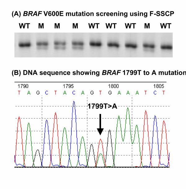 https://cdn.ncbi.nlm.nih.gov/pmc/blobs/ac13/1360090/972a51e40a49/1476-4598-5-2-1.jpg