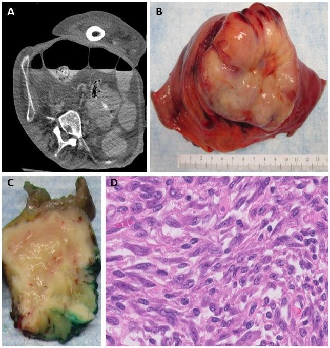 https://cdn.ncbi.nlm.nih.gov/pmc/blobs/ac14/11751603/60c3120caa63/bcr-18-1-g001.jpg
