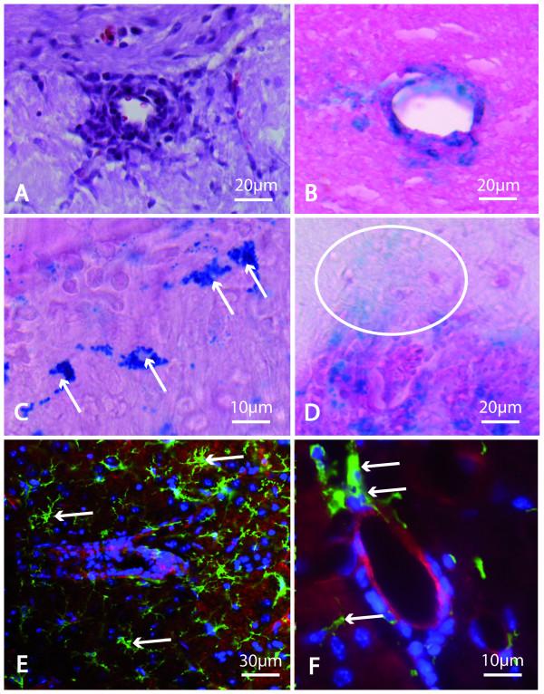 https://cdn.ncbi.nlm.nih.gov/pmc/blobs/ac16/2731086/093b80aa40ca/1742-2094-6-20-3.jpg