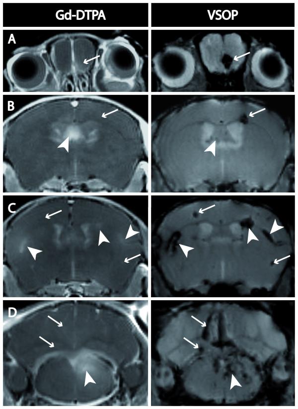 https://cdn.ncbi.nlm.nih.gov/pmc/blobs/ac16/2731086/680fed15ea5f/1742-2094-6-20-2.jpg