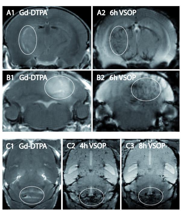 https://cdn.ncbi.nlm.nih.gov/pmc/blobs/ac16/2731086/b9cc5acdd70b/1742-2094-6-20-4.jpg