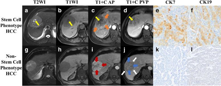 https://cdn.ncbi.nlm.nih.gov/pmc/blobs/ac19/10645671/eca0591ccdec/13244_2023_1539_Fig2_HTML.jpg