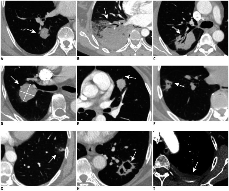 https://cdn.ncbi.nlm.nih.gov/pmc/blobs/ac19/8005341/ae71019f1aeb/kjr-22-652-g001.jpg