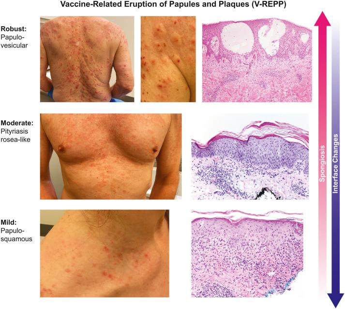 https://cdn.ncbi.nlm.nih.gov/pmc/blobs/ac1b/8431833/1bc529680b9b/gr1_lrg.jpg
