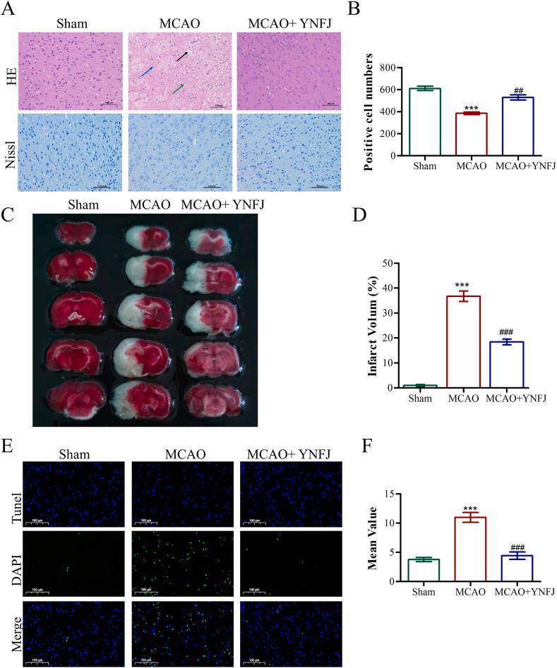 https://cdn.ncbi.nlm.nih.gov/pmc/blobs/ac1f/10776953/9cc175537be6/gr3.jpg