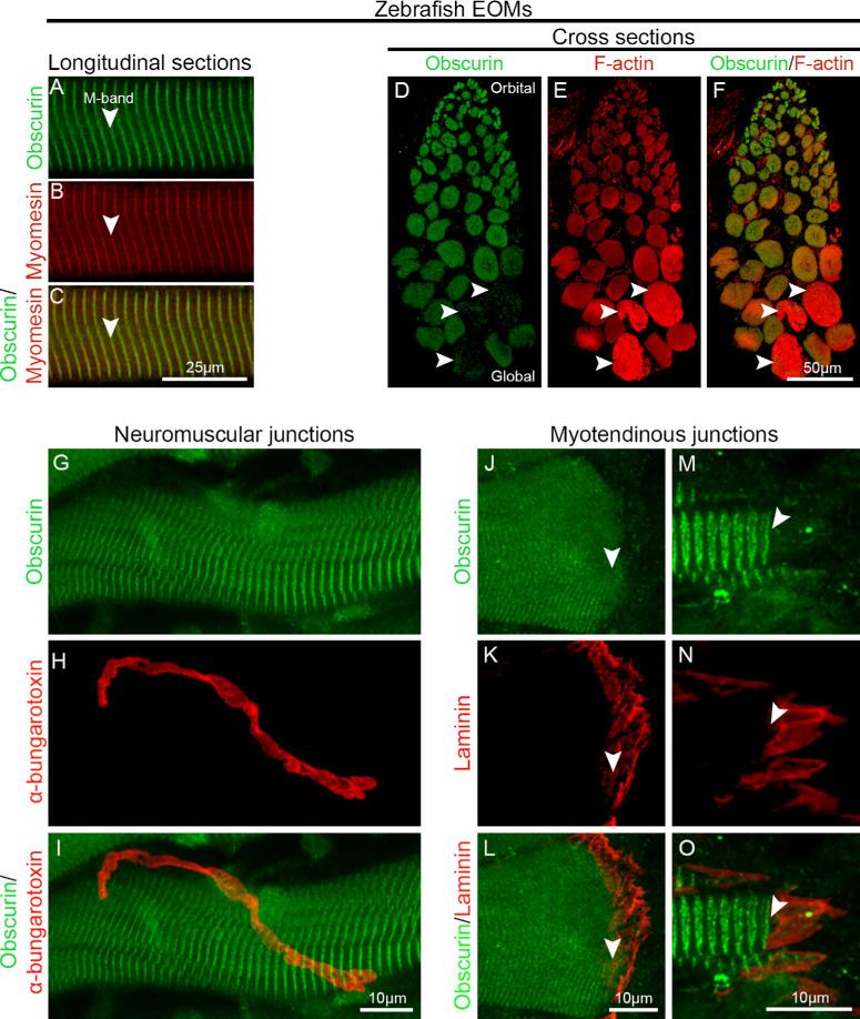 https://cdn.ncbi.nlm.nih.gov/pmc/blobs/ac23/10860686/6d6368b81bc1/iovs-65-2-19-f002.jpg