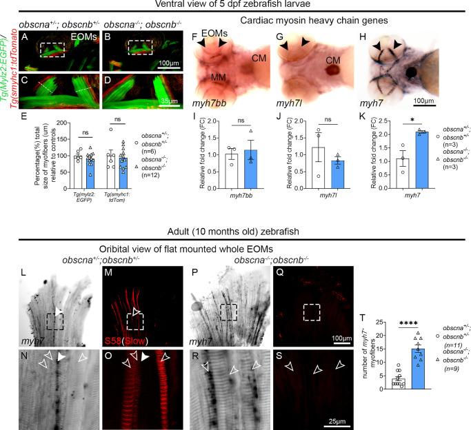 https://cdn.ncbi.nlm.nih.gov/pmc/blobs/ac23/10860686/7779fde737be/iovs-65-2-19-f005.jpg
