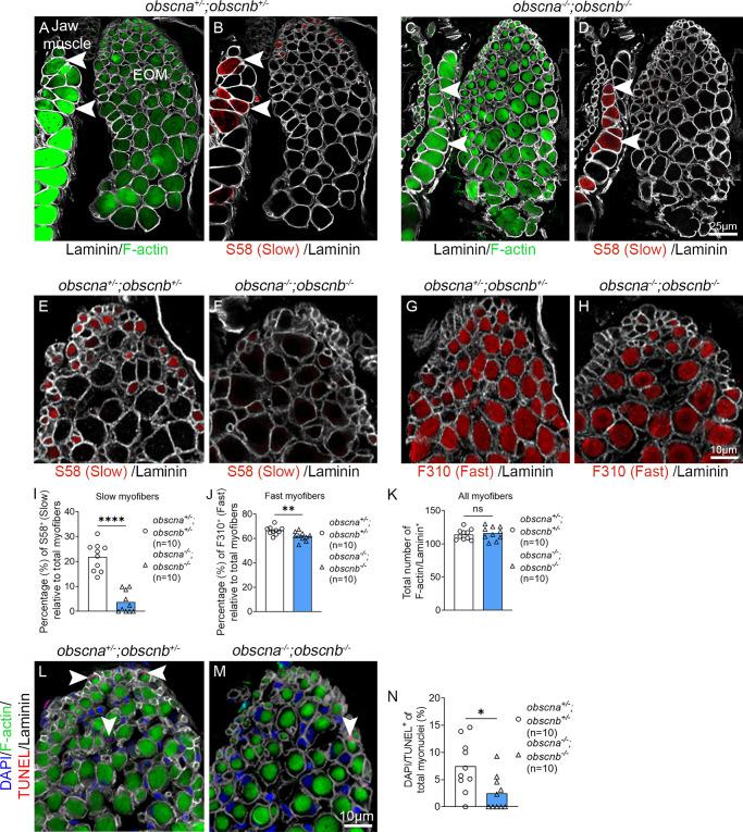 https://cdn.ncbi.nlm.nih.gov/pmc/blobs/ac23/10860686/84b105f71ced/iovs-65-2-19-f004.jpg