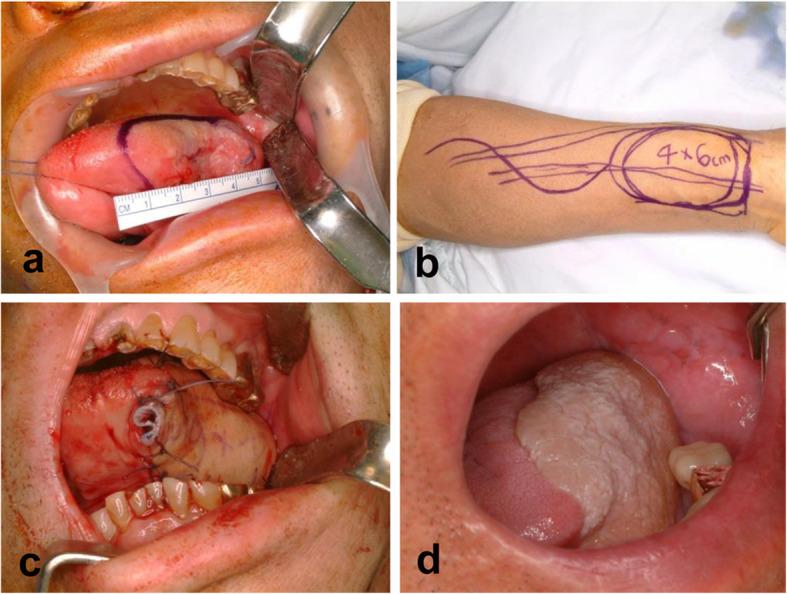 https://cdn.ncbi.nlm.nih.gov/pmc/blobs/ac33/7447709/ed211d9bcfc3/40902_2020_273_Fig1_HTML.jpg