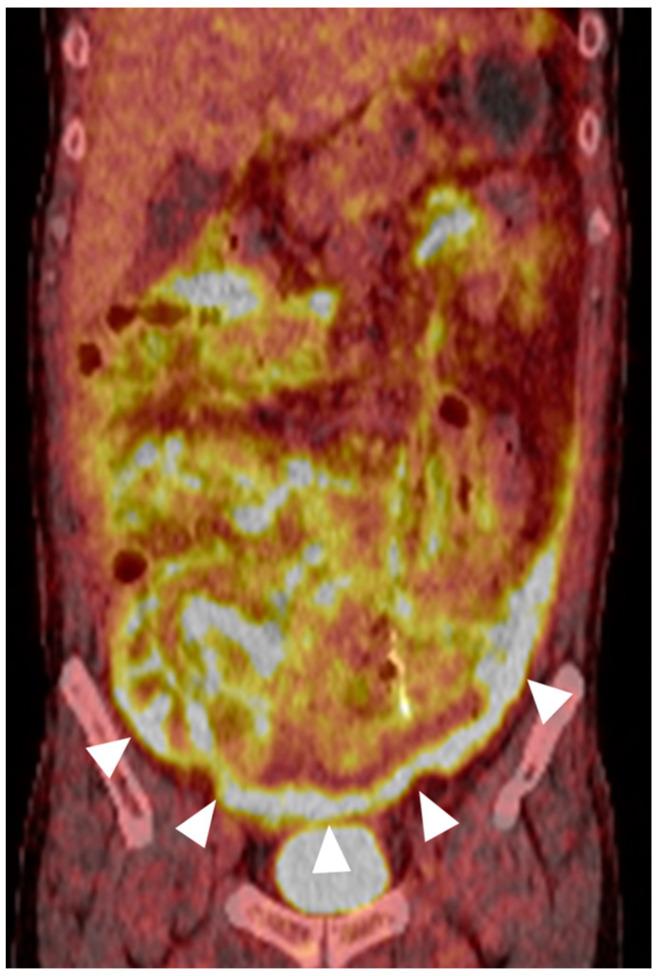 https://cdn.ncbi.nlm.nih.gov/pmc/blobs/ac34/11171937/9f72bd93cefa/diagnostics-14-01062-g003.jpg