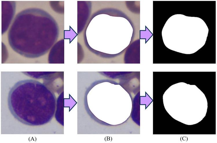 https://cdn.ncbi.nlm.nih.gov/pmc/blobs/ac37/11624523/b9d8f39ef3a1/JMDH-17-5675-g0007.jpg