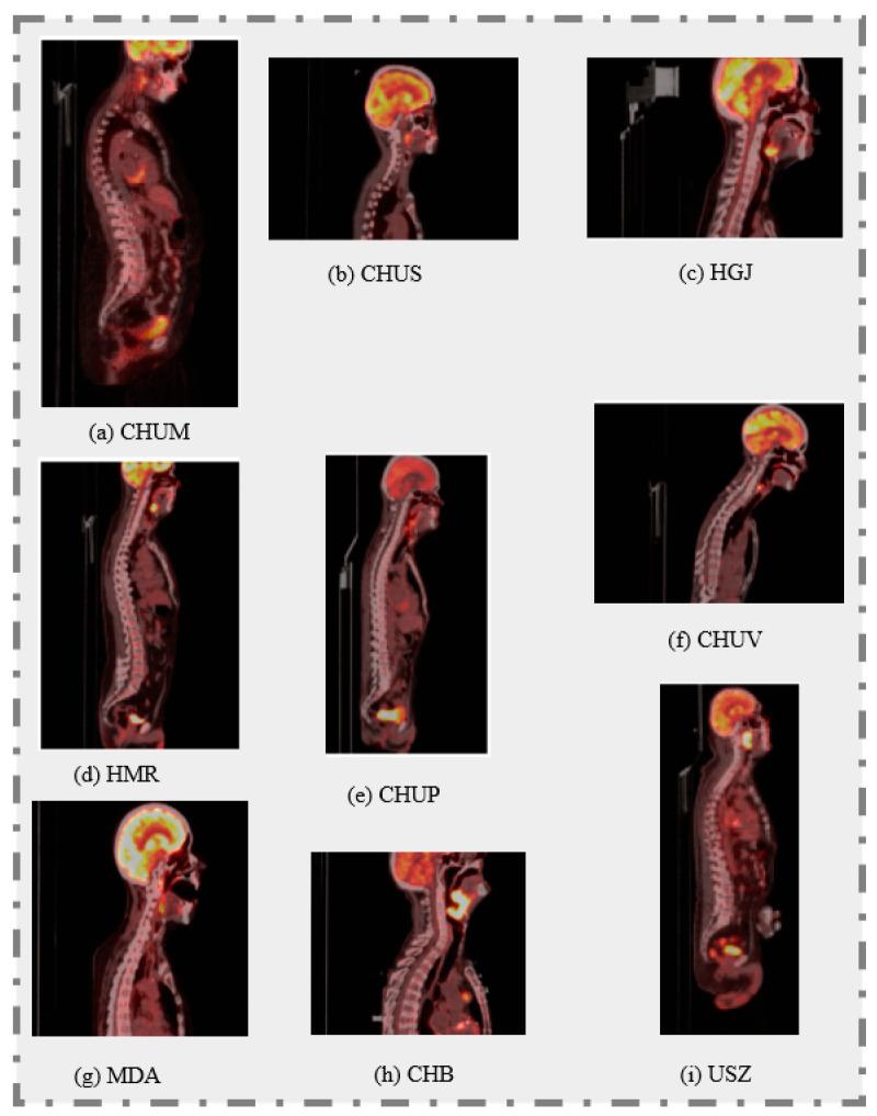 https://cdn.ncbi.nlm.nih.gov/pmc/blobs/ac38/11431645/070eb8c2de56/diagnostics-14-02038-g001.jpg