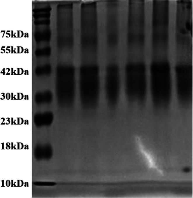 https://cdn.ncbi.nlm.nih.gov/pmc/blobs/ac3a/12319157/bdbeca004987/FSN3-13-e70541-g004.jpg