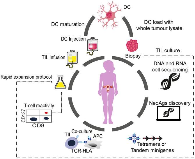https://cdn.ncbi.nlm.nih.gov/pmc/blobs/ac49/8072818/9af1a580df9f/10.1177_17588359211008399-fig1.jpg