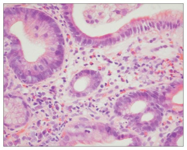 https://cdn.ncbi.nlm.nih.gov/pmc/blobs/ac4c/5417776/455cc618444b/gnl-11-349f1.jpg
