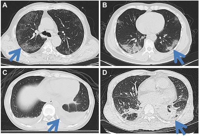 https://cdn.ncbi.nlm.nih.gov/pmc/blobs/ac4d/9120763/f3b6fc1aca1e/fmicb-13-847836-g004.jpg