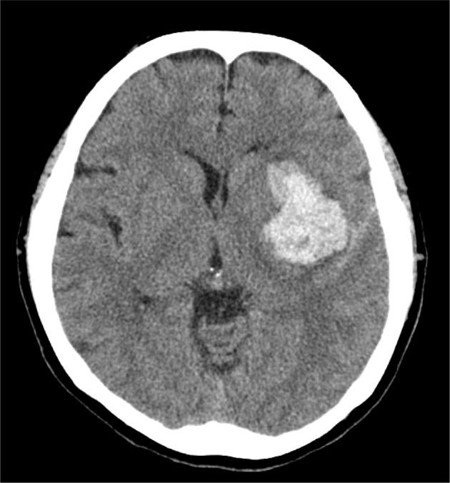 https://cdn.ncbi.nlm.nih.gov/pmc/blobs/ac50/12045614/35be31397393/jpts-37-231-g001.jpg