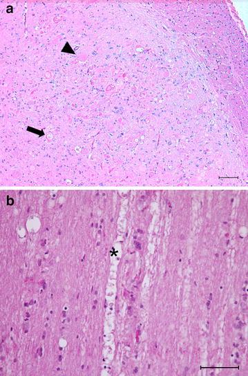 https://cdn.ncbi.nlm.nih.gov/pmc/blobs/ac50/4895804/fa1492ed2c03/13028_2016_218_Fig2_HTML.jpg