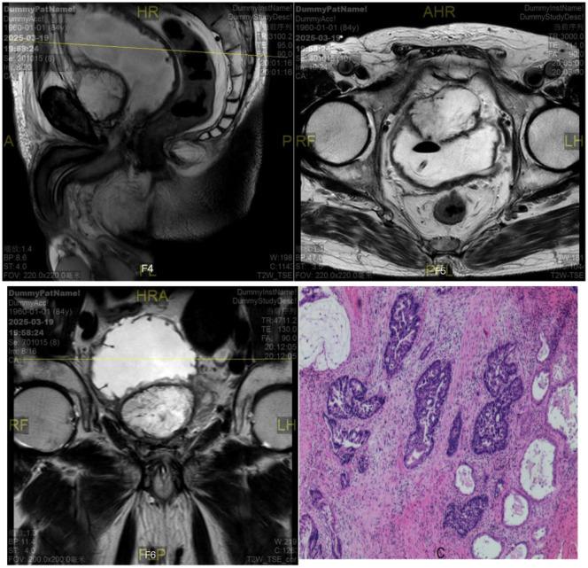 https://cdn.ncbi.nlm.nih.gov/pmc/blobs/ac55/12390961/6847c2d80b81/fonc-15-1645306-g003.jpg