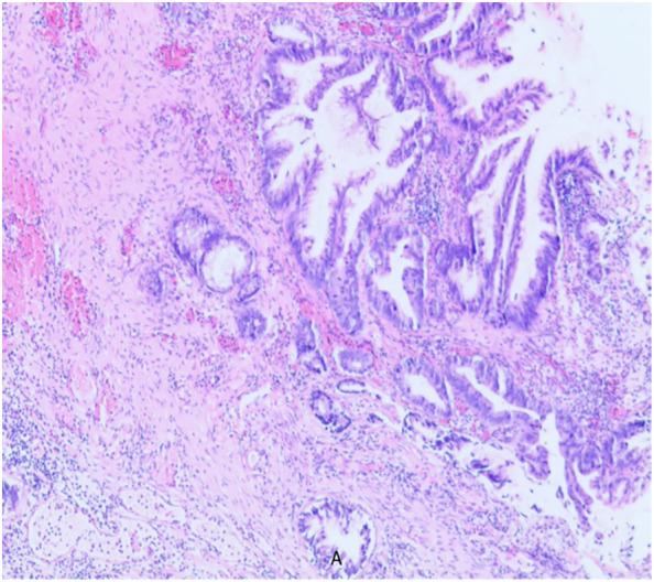 https://cdn.ncbi.nlm.nih.gov/pmc/blobs/ac55/12390961/ff5d7cab66e7/fonc-15-1645306-g001.jpg