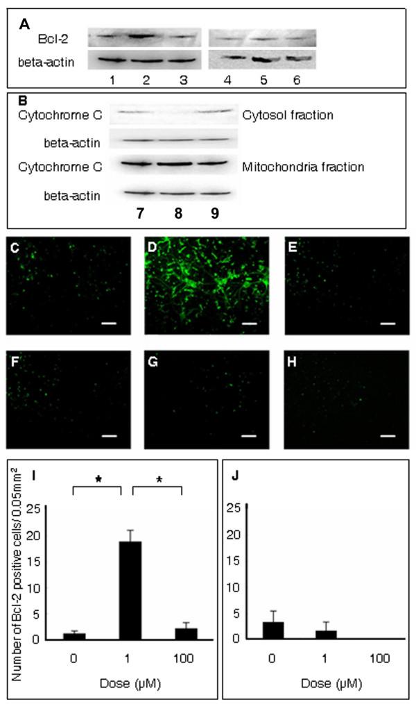 https://cdn.ncbi.nlm.nih.gov/pmc/blobs/ac55/2762982/7b8f25b22238/1471-2202-10-126-3.jpg