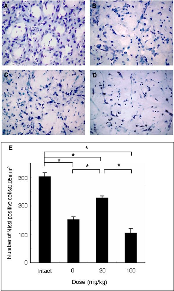 https://cdn.ncbi.nlm.nih.gov/pmc/blobs/ac55/2762982/e8fcce1122b6/1471-2202-10-126-8.jpg