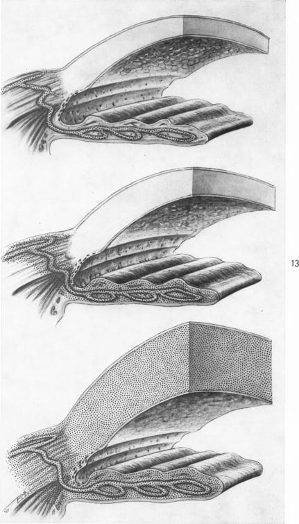 https://cdn.ncbi.nlm.nih.gov/pmc/blobs/ac58/1965414/9cf3ae7354b2/amjpathol00265-0068-a.jpg