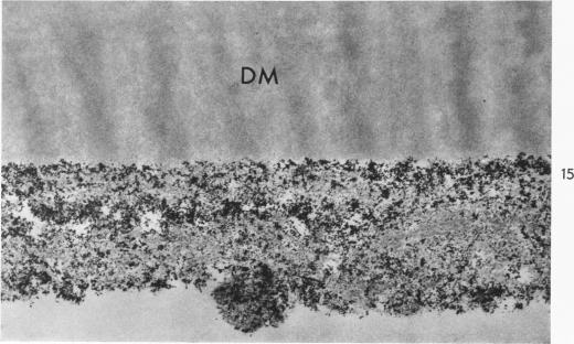 https://cdn.ncbi.nlm.nih.gov/pmc/blobs/ac58/1965414/c8757d567da5/amjpathol00265-0070-b.jpg