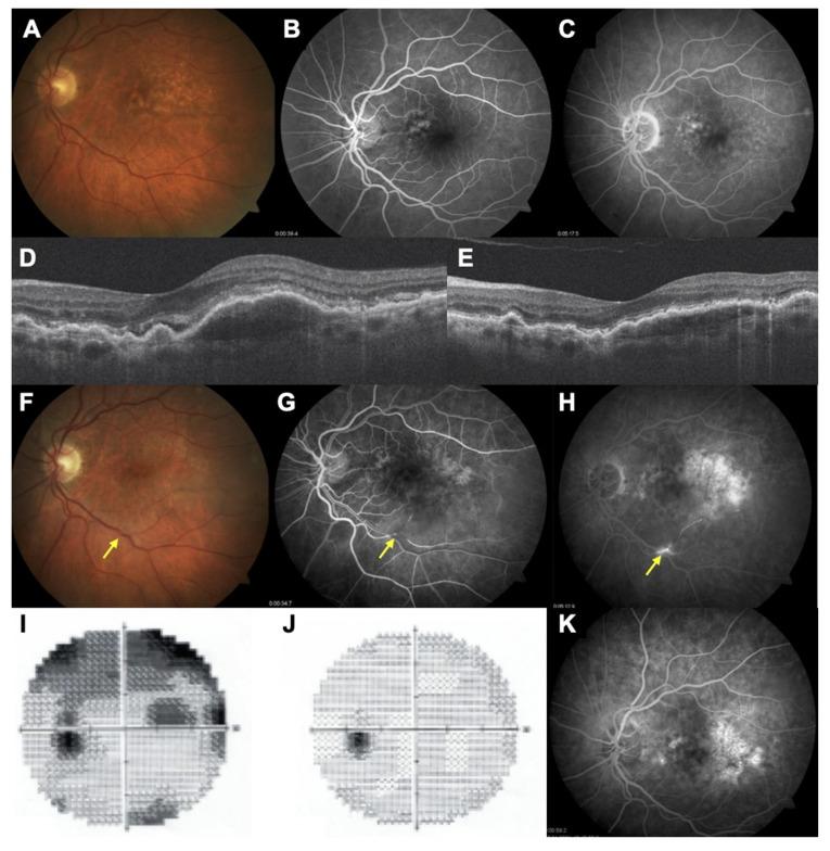 https://cdn.ncbi.nlm.nih.gov/pmc/blobs/ac5a/8268719/55034cc67845/jcm-10-02758-g004.jpg