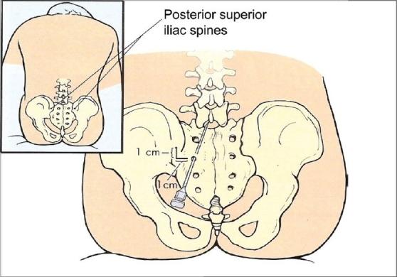 https://cdn.ncbi.nlm.nih.gov/pmc/blobs/ac5c/2876933/123072d15403/SJA-03-87-g002.jpg