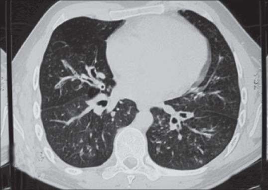 https://cdn.ncbi.nlm.nih.gov/pmc/blobs/ac6f/4248507/dbcd8ef29ee5/IJD-59-614-g002.jpg