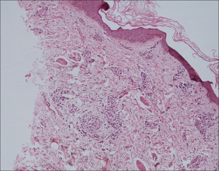 https://cdn.ncbi.nlm.nih.gov/pmc/blobs/ac6f/4248507/fe90f3ad9290/IJD-59-614-g003.jpg
