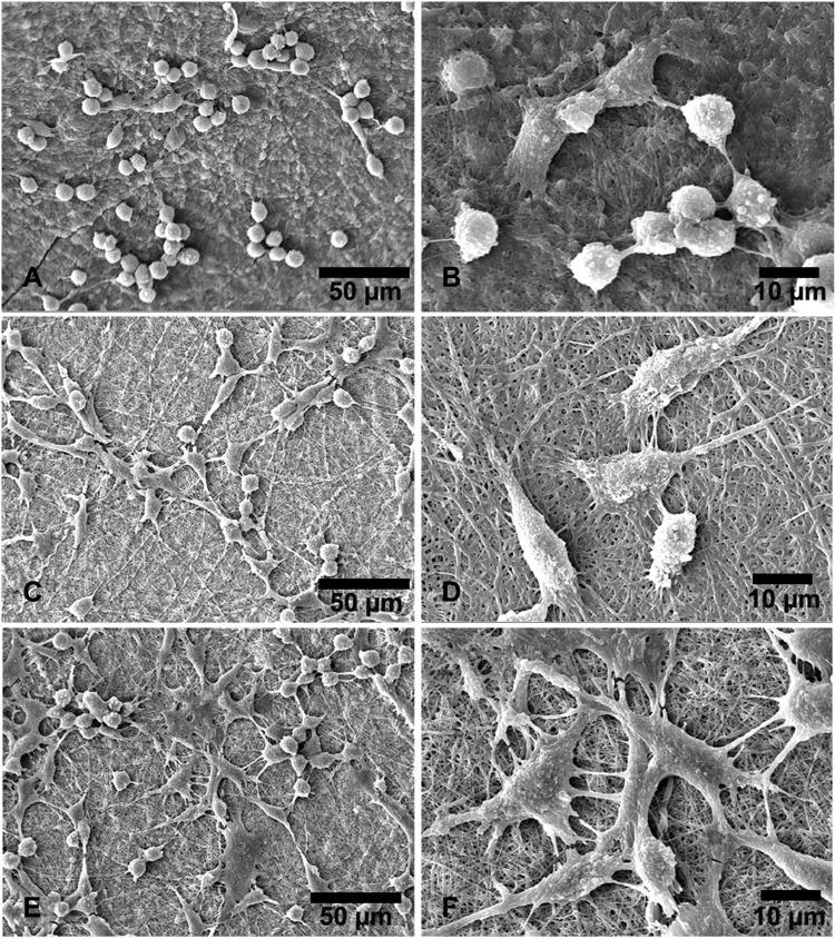 https://cdn.ncbi.nlm.nih.gov/pmc/blobs/ac79/9464040/11cbd4bdd0a7/IJN-17-3913-g0007.jpg