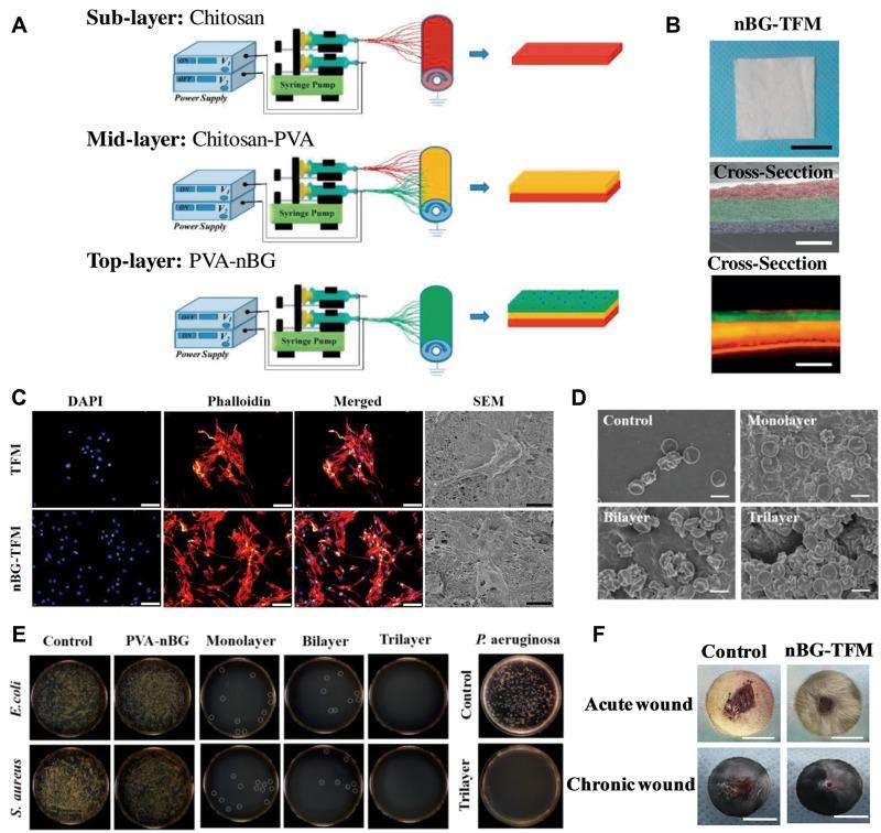 https://cdn.ncbi.nlm.nih.gov/pmc/blobs/ac79/9464040/521144a523da/IJN-17-3913-g0005.jpg