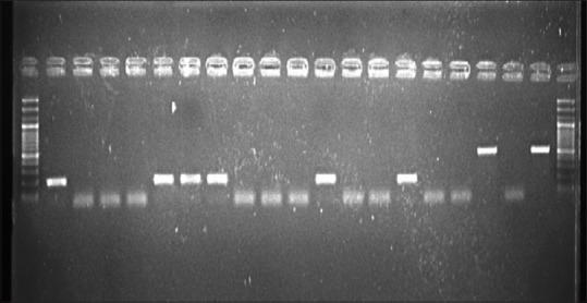 https://cdn.ncbi.nlm.nih.gov/pmc/blobs/ac80/10112116/8080345b0adf/JOMFP-26-495-g002.jpg