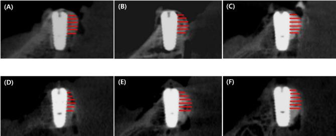 https://cdn.ncbi.nlm.nih.gov/pmc/blobs/ac85/12141711/c14481ed1745/40729_2025_631_Fig8_HTML.jpg
