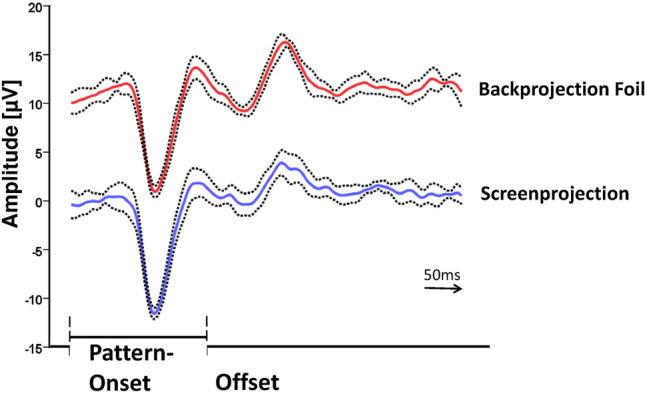 https://cdn.ncbi.nlm.nih.gov/pmc/blobs/ac85/8913566/d8fff13f20d2/417_2021_5473_Fig2_HTML.jpg