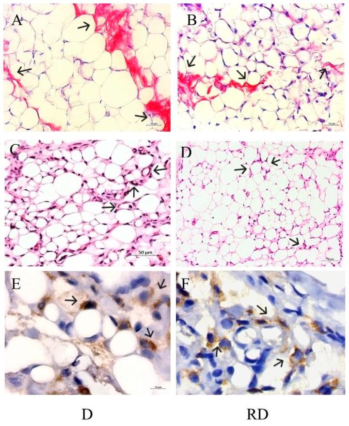 https://cdn.ncbi.nlm.nih.gov/pmc/blobs/ac87/11855909/7a1dea9aedfe/ijms-26-01672-g009.jpg