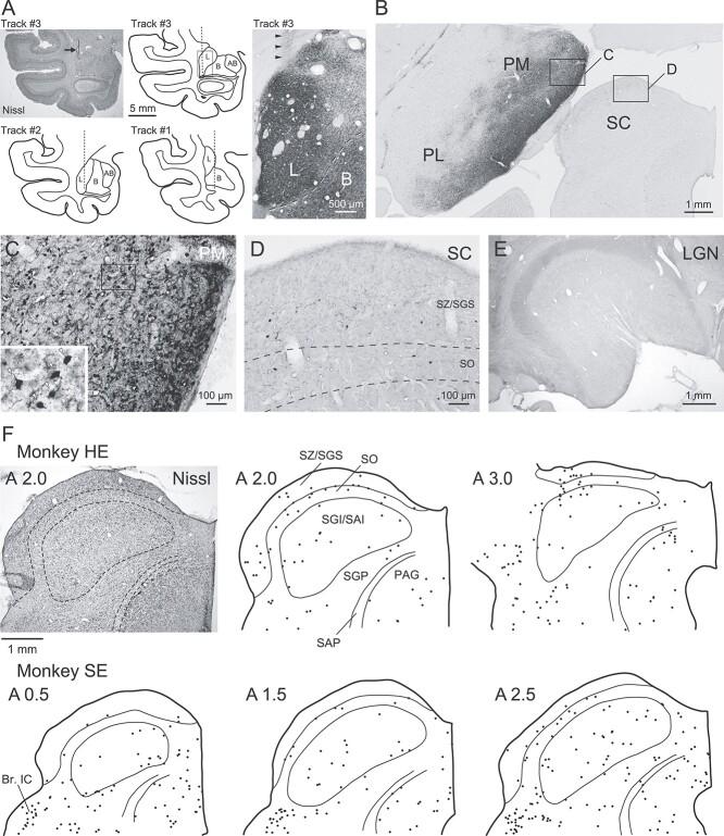https://cdn.ncbi.nlm.nih.gov/pmc/blobs/ac8a/9890477/6b0b74736908/bhac109f7.jpg