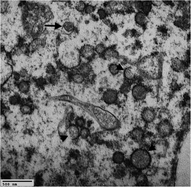 https://cdn.ncbi.nlm.nih.gov/pmc/blobs/ac8b/7443185/2d27f433bce2/428_2020_2886_Fig4_HTML.jpg