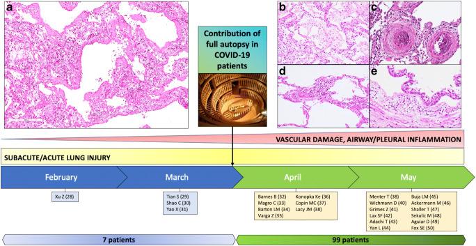 https://cdn.ncbi.nlm.nih.gov/pmc/blobs/ac8b/7443185/3e19b439e39a/428_2020_2886_Fig2_HTML.jpg