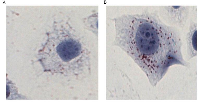 https://cdn.ncbi.nlm.nih.gov/pmc/blobs/ac8d/5639305/a2ce58b5546f/etm-14-04-3632-g00.jpg