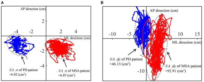 https://cdn.ncbi.nlm.nih.gov/pmc/blobs/ac8e/9868697/e97d70eba160/fneur-13-1089439-g0002.jpg