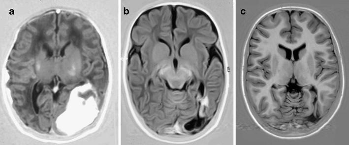 https://cdn.ncbi.nlm.nih.gov/pmc/blobs/ac93/2872016/18468b59b9cd/234_2010_698_Fig2_HTML.jpg