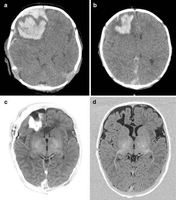 https://cdn.ncbi.nlm.nih.gov/pmc/blobs/ac93/2872016/dbc1340331b5/234_2010_698_Fig1_HTML.jpg