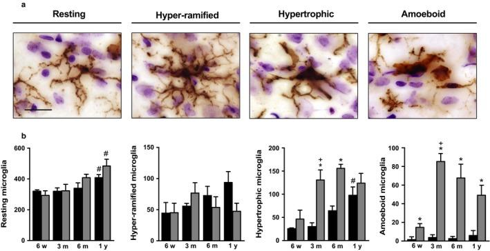 https://cdn.ncbi.nlm.nih.gov/pmc/blobs/ac95/5847868/61d15a8a1fc6/ACEL-17-e12727-g004.jpg