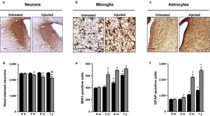https://cdn.ncbi.nlm.nih.gov/pmc/blobs/ac95/5847868/e6c3e3f3199e/ACEL-17-e12727-g003.jpg