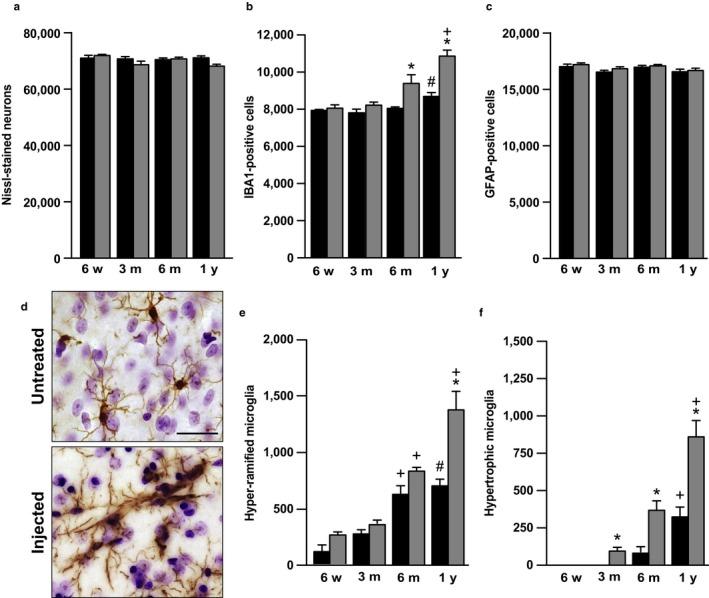 https://cdn.ncbi.nlm.nih.gov/pmc/blobs/ac95/5847868/ec39aee61665/ACEL-17-e12727-g005.jpg